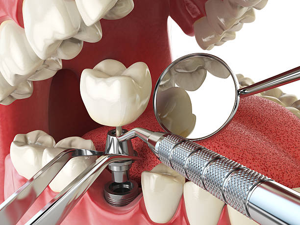 Best Emergency Dental Surgery in Rochester, MI
